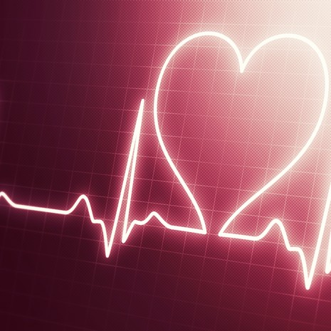 katetriablaatio. rytmihäiriö