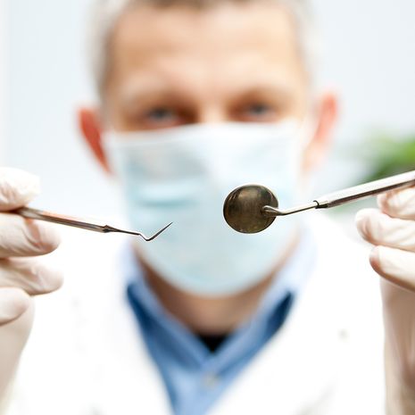 hammasärky, karies, juurihoito, paikkaus, hampaan poisto