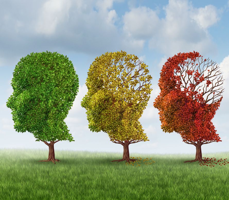 muisti, muistihäiriöt, Alzheimerin tauri, dementia