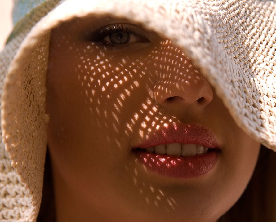 ruusufinni, aurinkosuoja