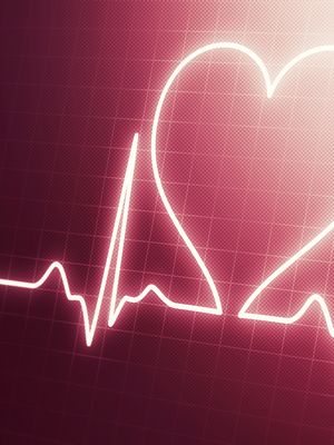 katetriablaatio. rytmihäiriö