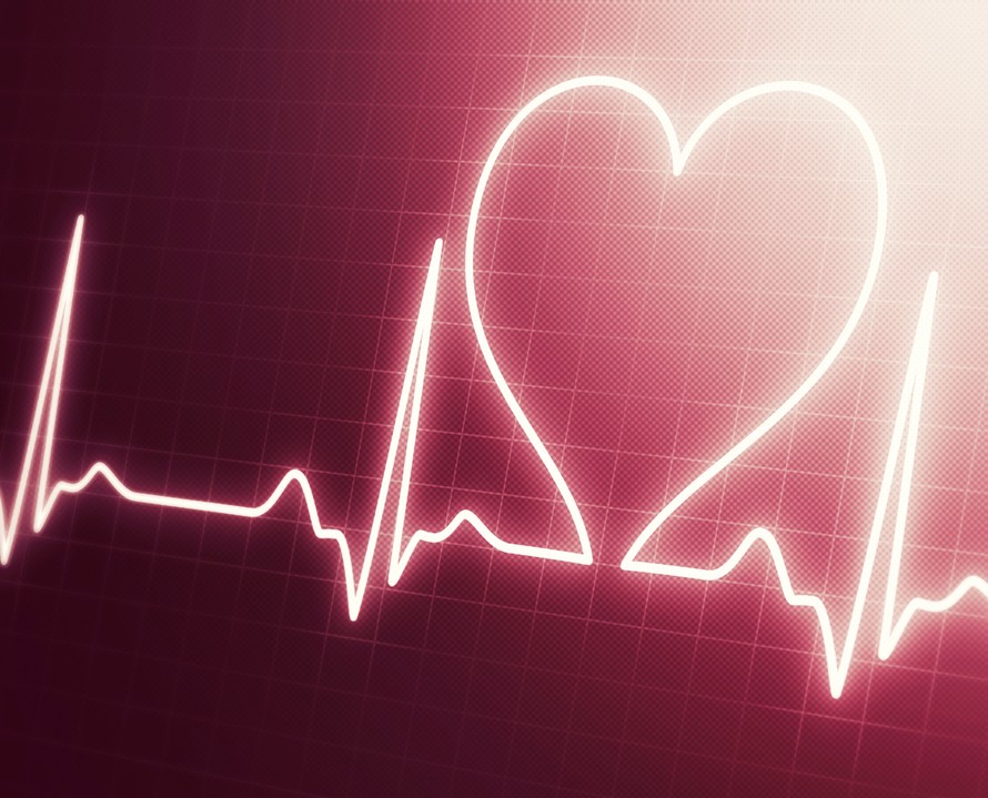 katetriablaatio. rytmihäiriö