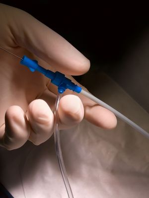  katetrointi sydän katetriablaatio