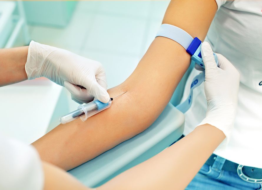 verikokeet, laboratoriokokeet