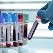 laboratoriokokeet, kolesteroli, verenpaine, sokerirasitus