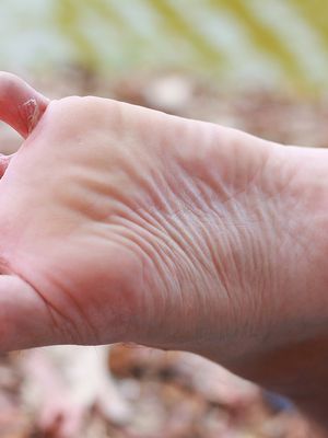 jalkasilsa, jalkasieni