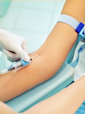 verikokeet, laboratoriokokeet