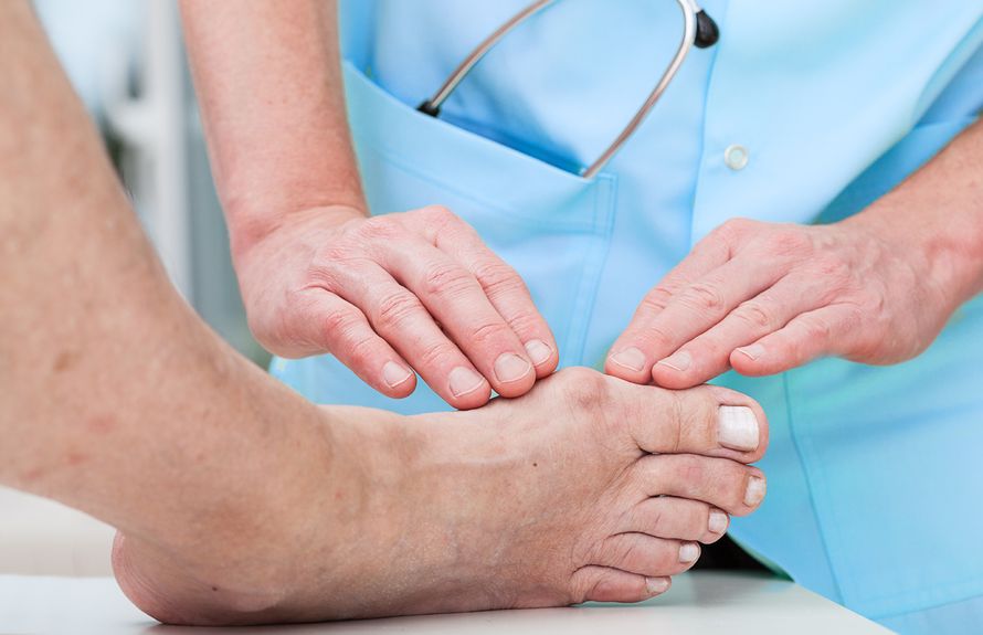 Vaivaisenluu uusii hoidosta huolimatta