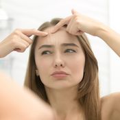 akne, minipillerit, hormonit